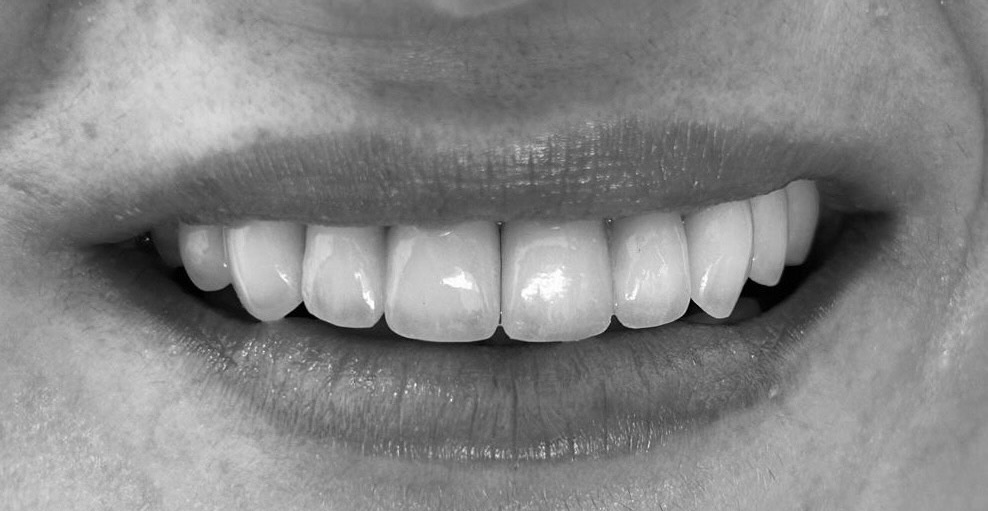 Cosmetic Dentistry Before